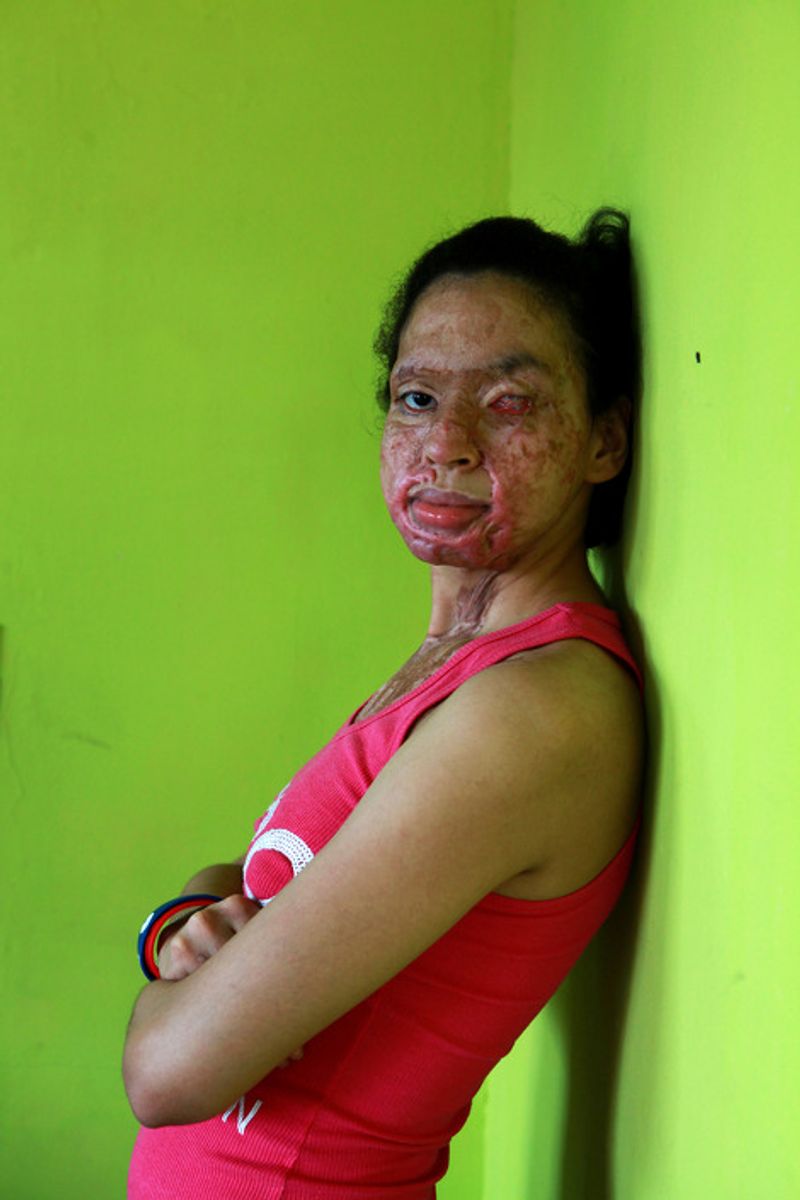 © Orlando Barria Photos - Image from the Women victims of acid photography project