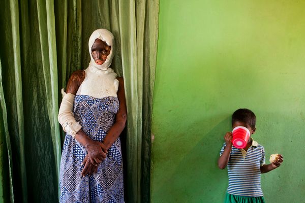 © Orlando Barria Photos - Image from the Women victims of acid photography project