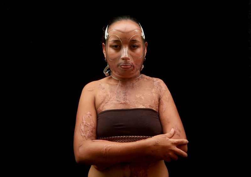 © Orlando Barria Photos - Image from the Women victims of acid photography project
