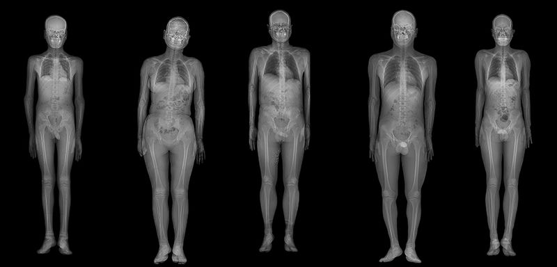 Anita Khemka and Imran Kokiloo / PHOTOINK