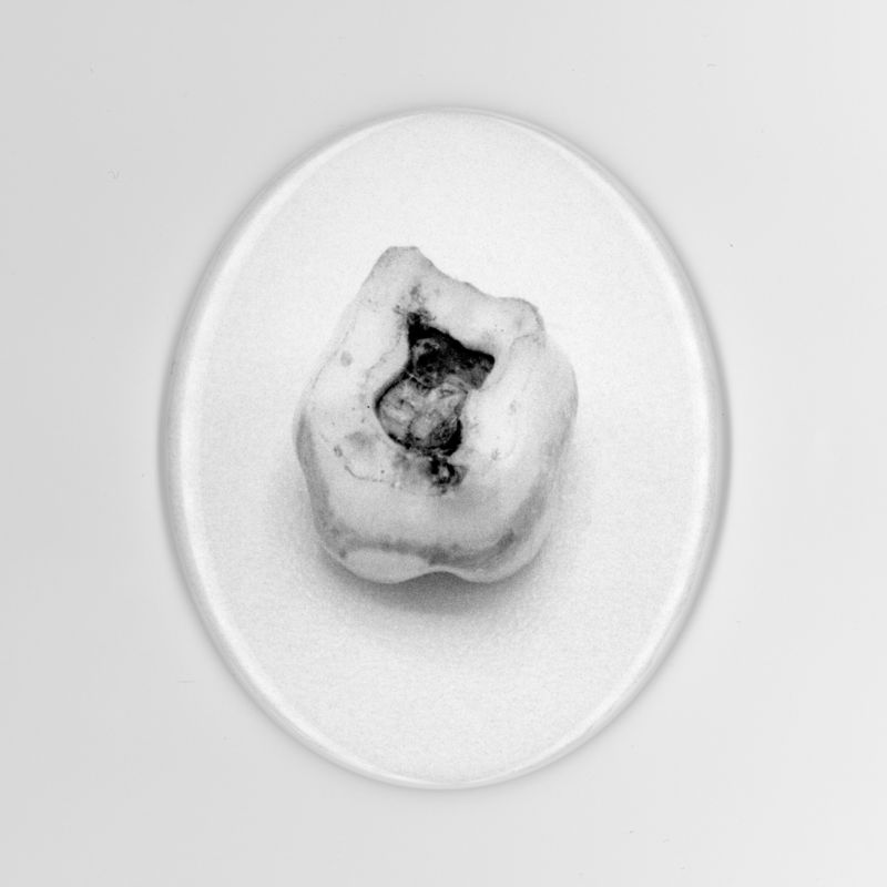 © Tommaso Sacconi - Deciduous teeth (a1)One of my deciduous teeth 198X - 199X 2019Rome