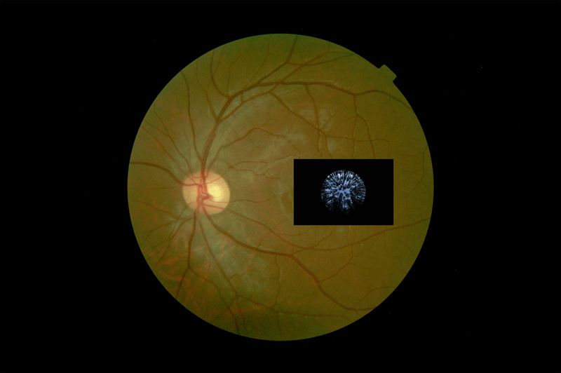 © Sheung Yiu - Hemispherical photograph of the canopy juxtaposed with a retinal image of my eye