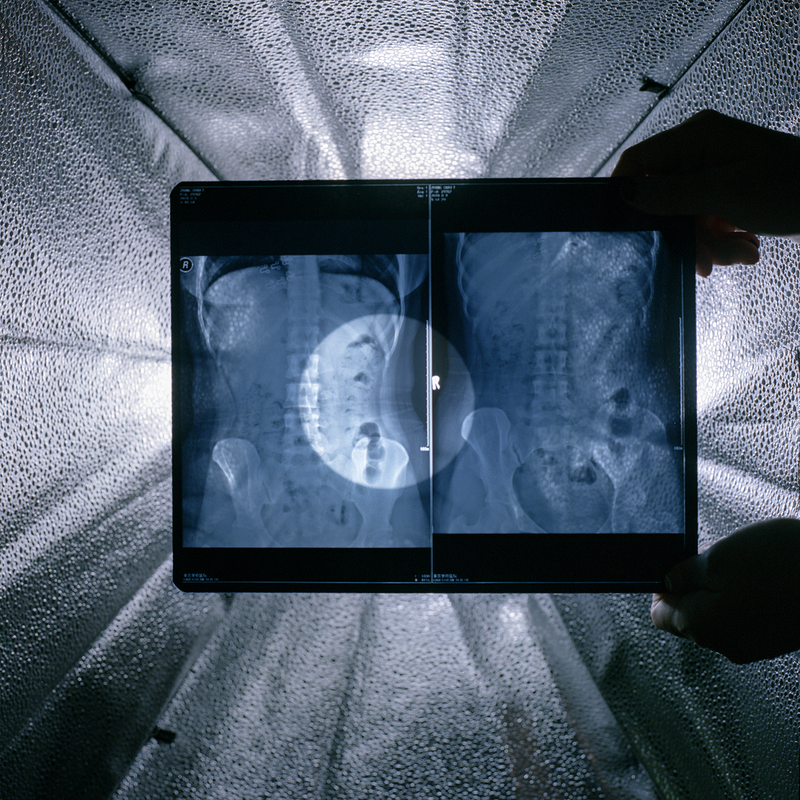 © Chao Zhang - Image from the Penia photography project