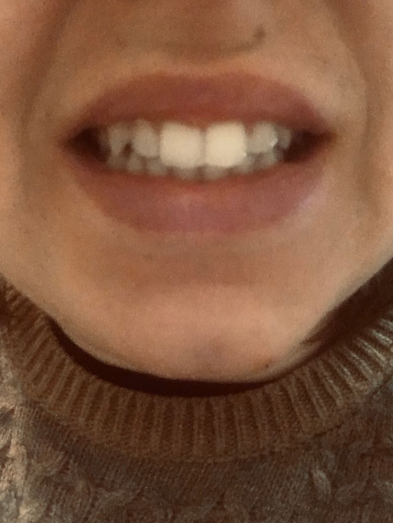 © Melissa Ianniello - 04