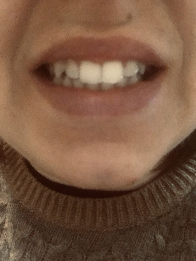 © Melissa Ianniello - 04