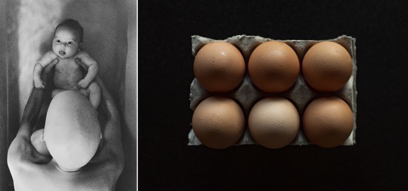 © Lisa Murray - When time is measured in treatment cycles and how much hair the other ‘egg heads’ have who surround me in oncology.