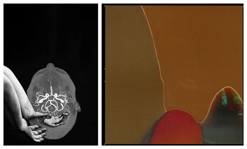 © Lisa Murray - THIS DELICATE BRAINUnderstanding my neurodivergent mind gives me a deeper insight into my sensitivities.