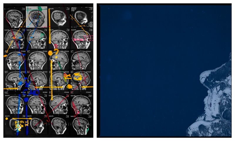 © Lisa Murray - TOPOGRAPHICAL DISORIENTATIONFinding a name for my innate inability to orient myself in my surroundings.