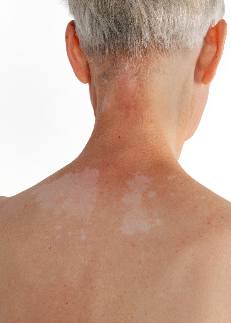 © Lina Czerny - Image from the Armor photography project