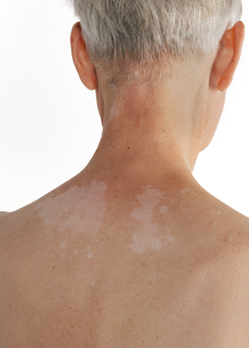 © Lina Czerny - Image from the Armor photography project