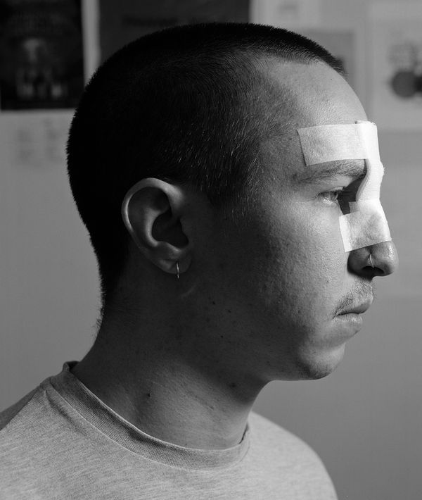 © Kent Andreasen - Luke with a broken Nose.