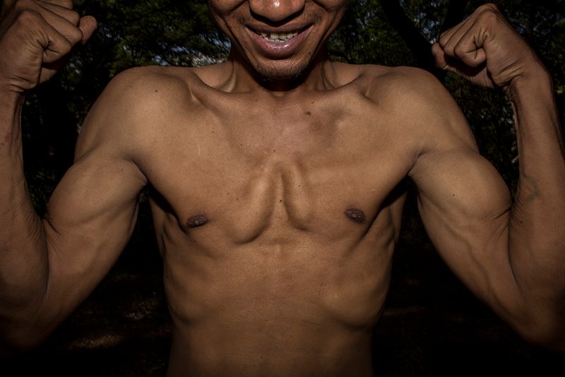 © Jaisingh Nageswaran - Image from the Skin photography project