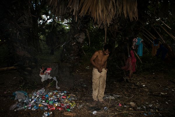 © Jaisingh Nageswaran - Image from the Skin photography project