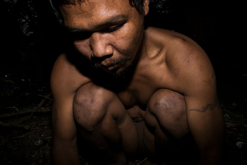 © Jaisingh Nageswaran - Image from the Skin photography project