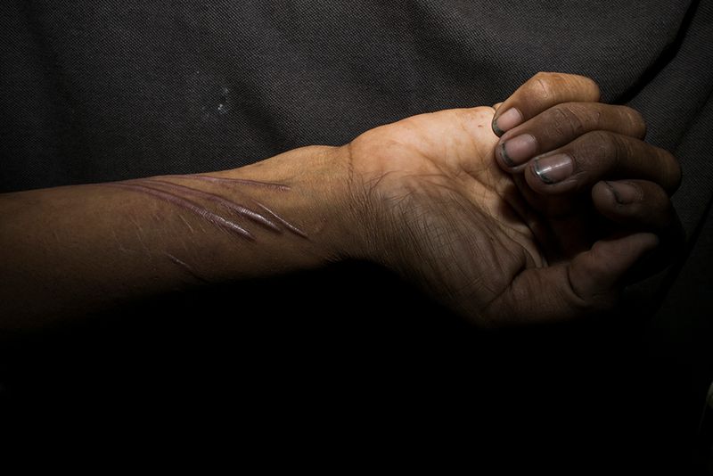 © Jaisingh Nageswaran - Image from the Skin photography project