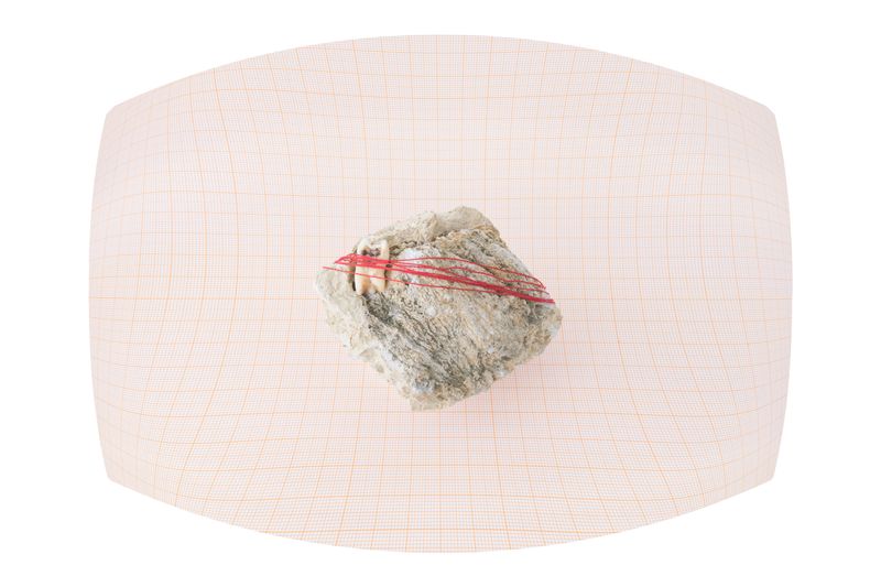 © Panos Charalampidis + Mary Chairetaki - Wisdom tooth. The picture is a product of Focus Stacking (Object view).