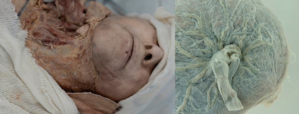 © Liza Ambrossio - 002_'The-Spanish-dead', from the series “The witch stage” (Ongoing)