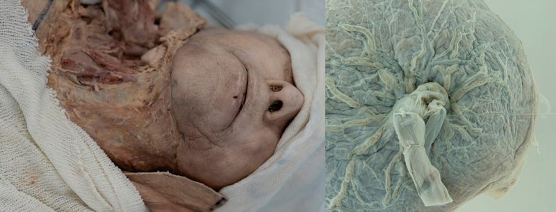 © Liza Ambrossio - 002_'The-Spanish-dead', from the series “The witch stage” (Ongoing)