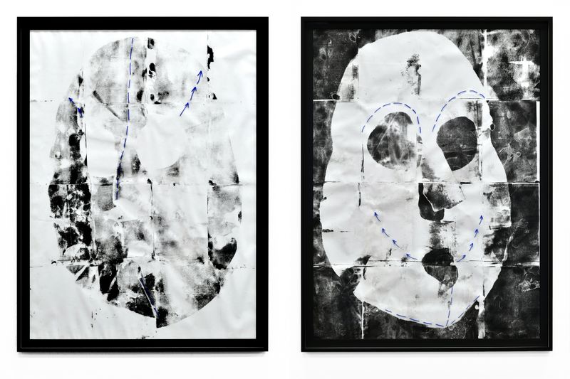 © Zoé Aubry - (my) carp A & B, pre-operative, from the series Faire écran, Transfer, Acrylic, Teleintervention Dr. Daniel da Rocha