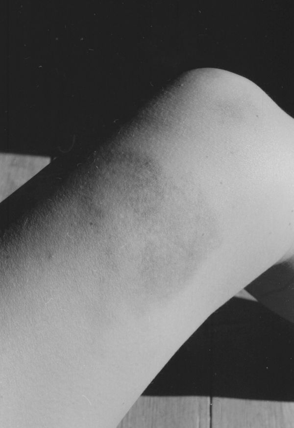 © Luisa Mielenz - Image from the Mangelnde Evidenz photography project