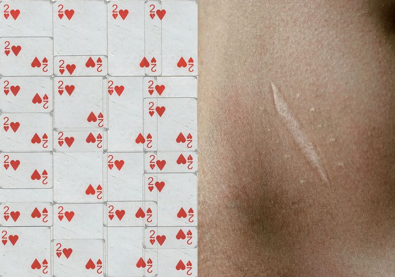 © Luis Cobelo - The woundSome scars leave deep loves.