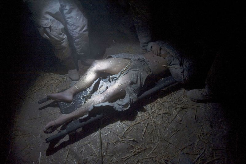 © Louie Palu - A soldier critically injured by a bombing in Bandi Temur, Panjwa'i District Kandahar, Afghanistan. Photo © Louie Palu