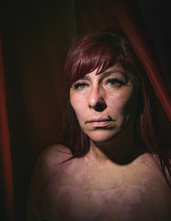 © Sebastian Pani and Belen Grosso, from the series And one day, the fire