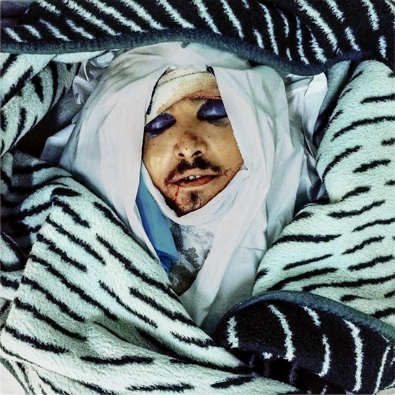 © Michael Christopher Brown. Libya. Misrata. 18 April, 2011. 12:03:04. Unidentified, at Hikma hospital.