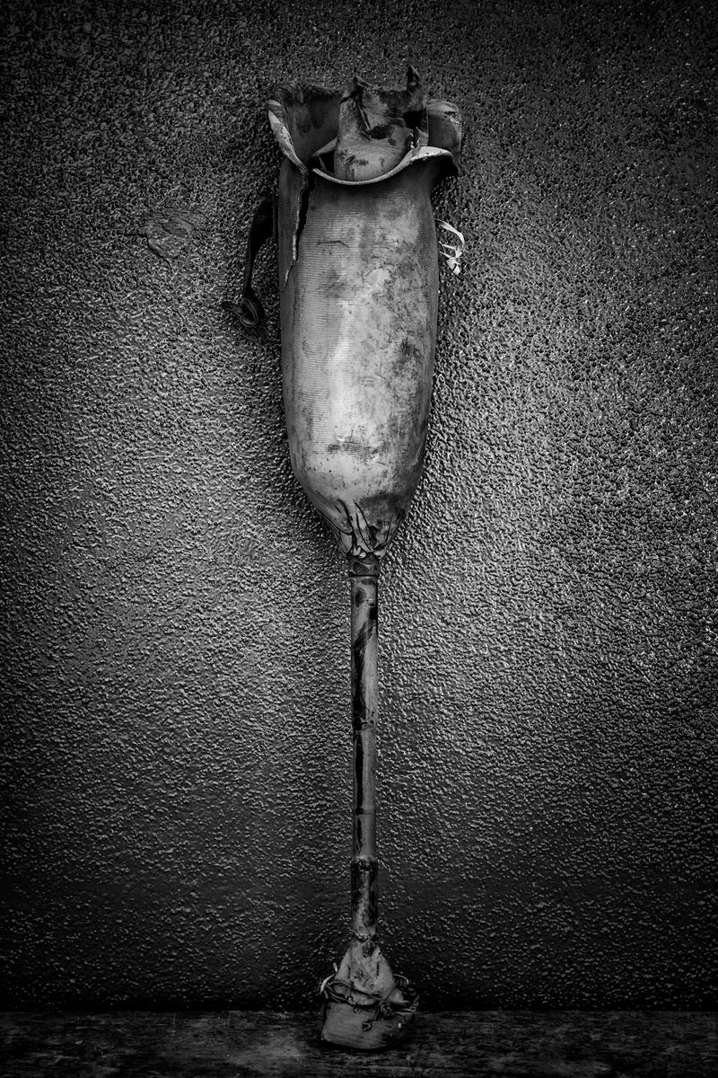 © Jose Silva Pinto - Image from the Lost Limbs photography project