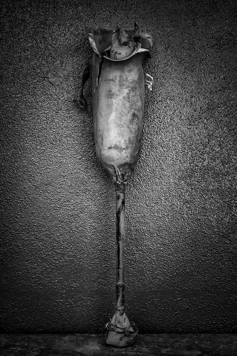 © Jose Silva Pinto - Image from the Lost Limbs photography project