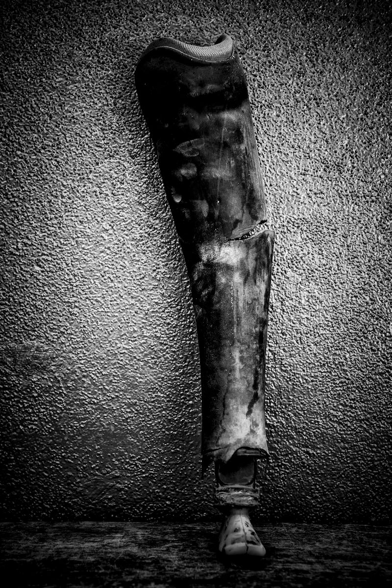 © Jose Silva Pinto - Image from the Lost Limbs photography project