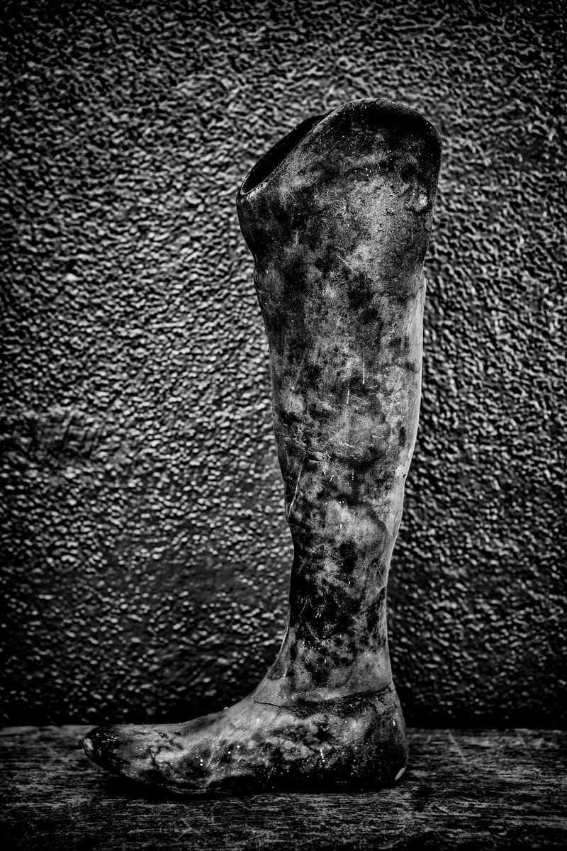 © Jose Silva Pinto - Image from the Lost Limbs photography project