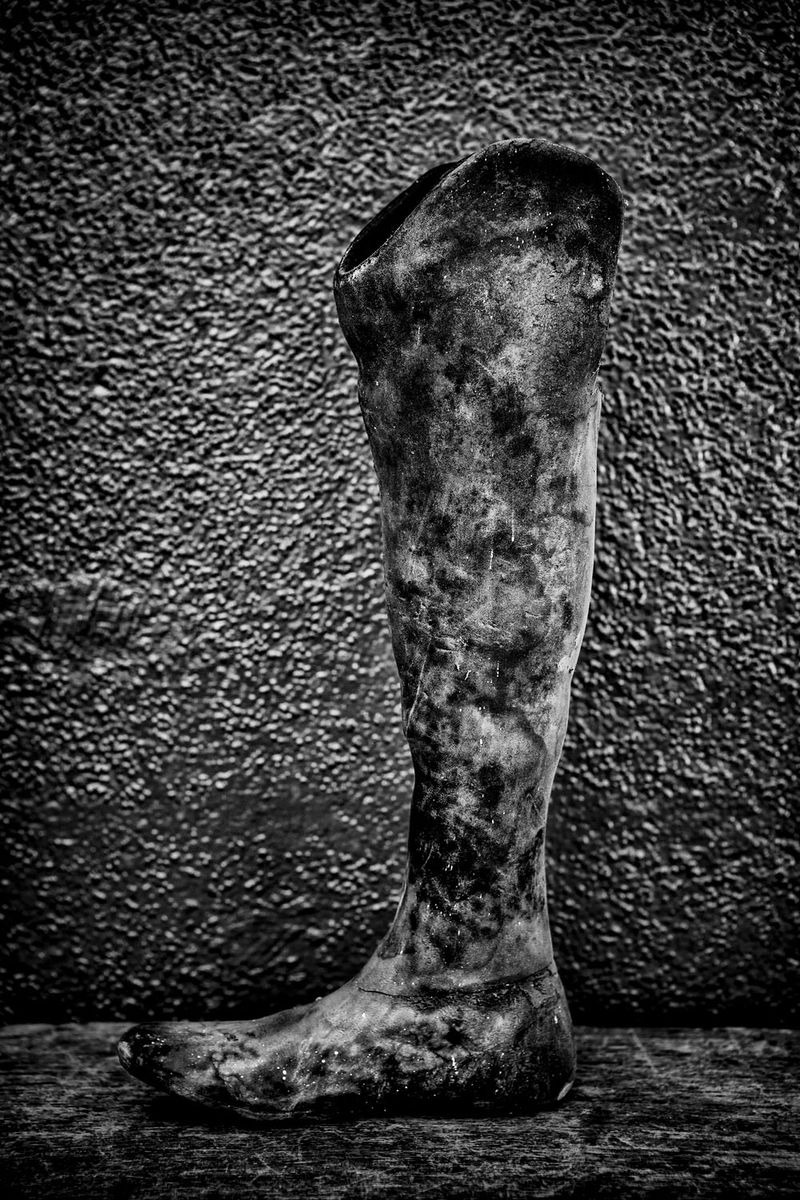 © Jose Silva Pinto - Image from the Lost Limbs photography project
