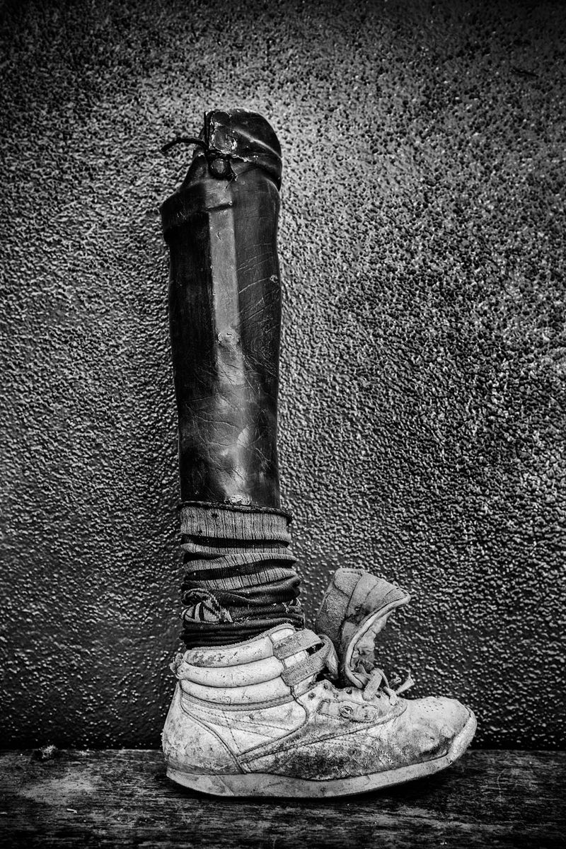 © Jose Silva Pinto - Image from the Lost Limbs photography project