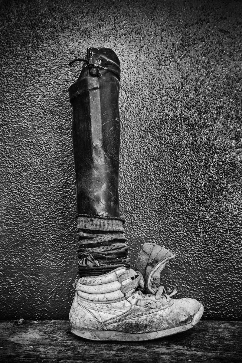 © Jose Silva Pinto - Image from the Lost Limbs photography project