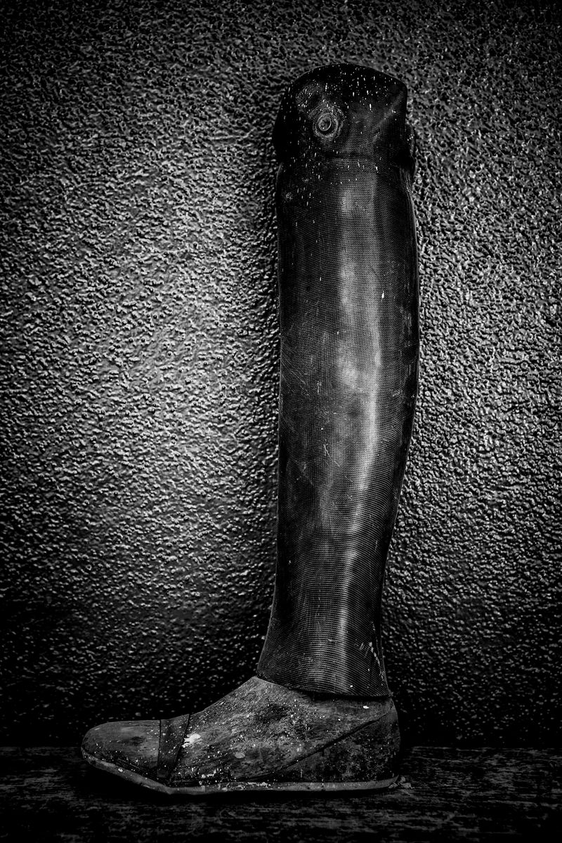 © Jose Silva Pinto - Image from the Lost Limbs photography project