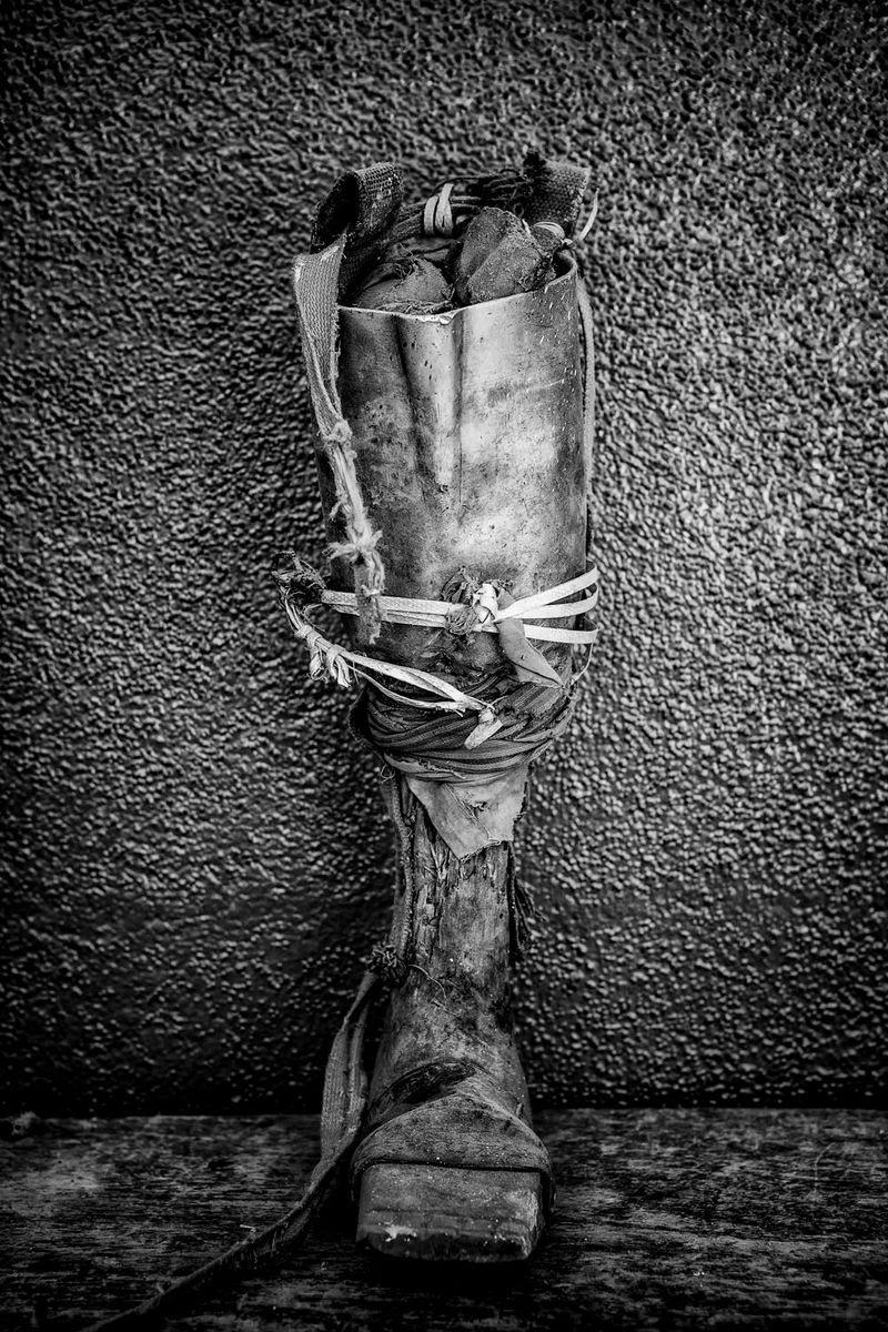 © Jose Silva Pinto - Image from the Lost Limbs photography project