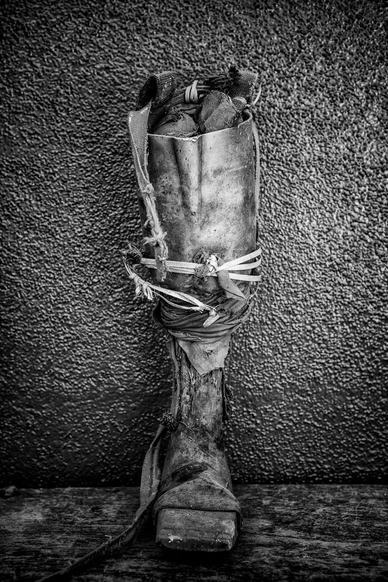 © Jose Silva Pinto - Image from the Lost Limbs photography project
