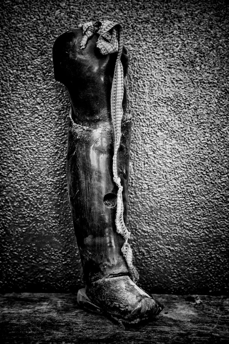 © Jose Silva Pinto - Image from the Lost Limbs photography project