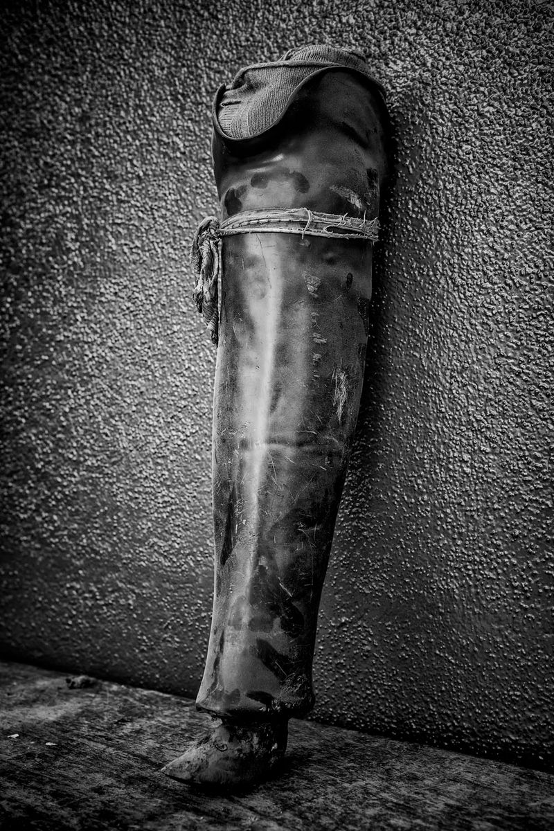 © Jose Silva Pinto - Image from the Lost Limbs photography project