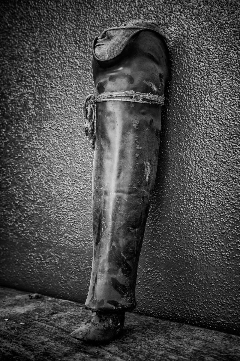© Jose Silva Pinto - Image from the Lost Limbs photography project