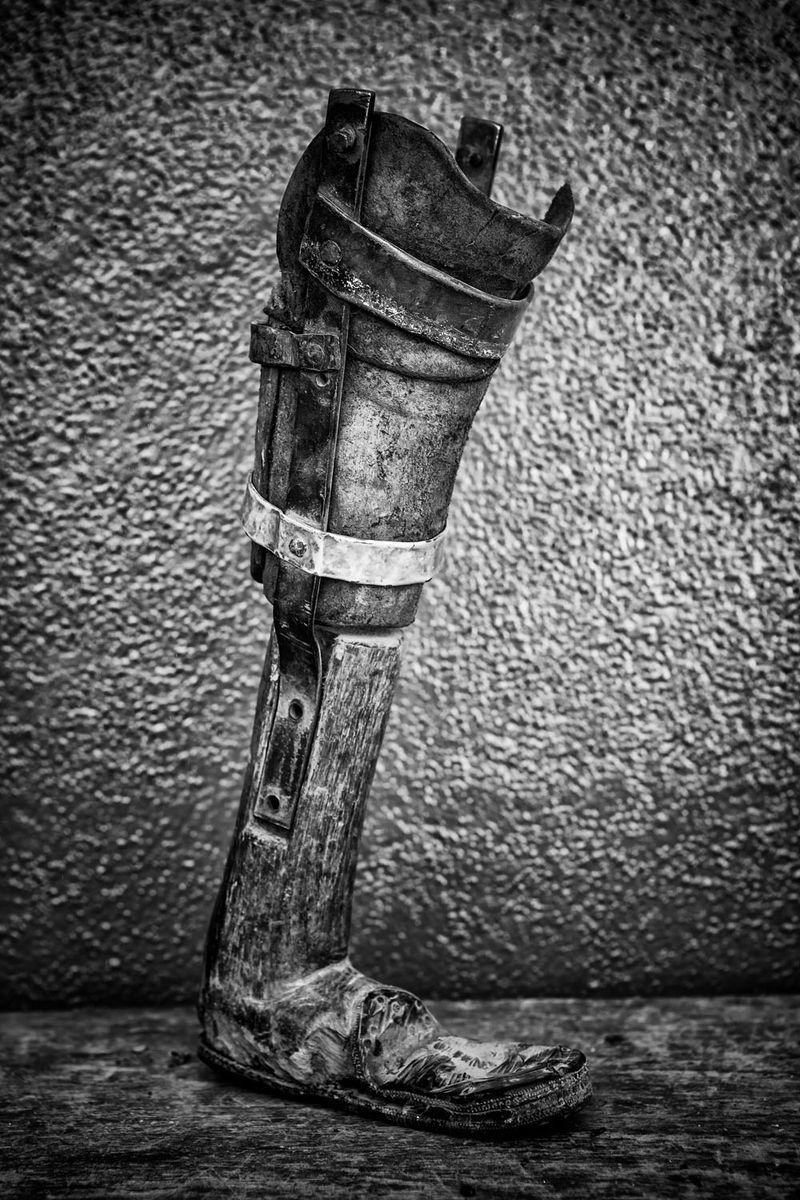 © Jose Silva Pinto - Image from the Lost Limbs photography project