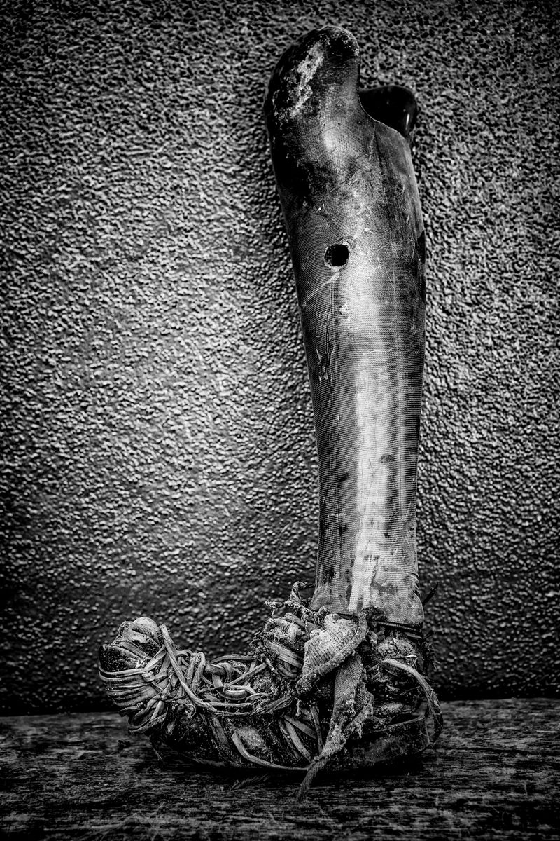 © Jose Silva Pinto - Image from the Lost Limbs photography project