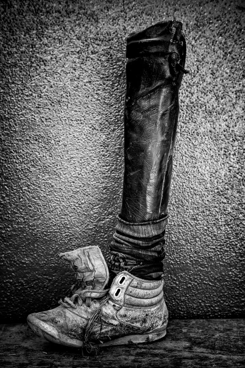 © Jose Silva Pinto - Image from the Lost Limbs photography project