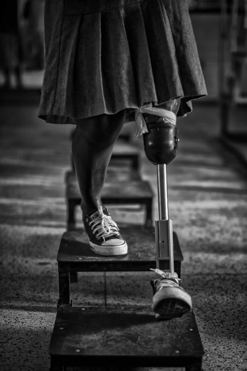© Jose Silva Pinto - Image from the Lost Limbs photography project