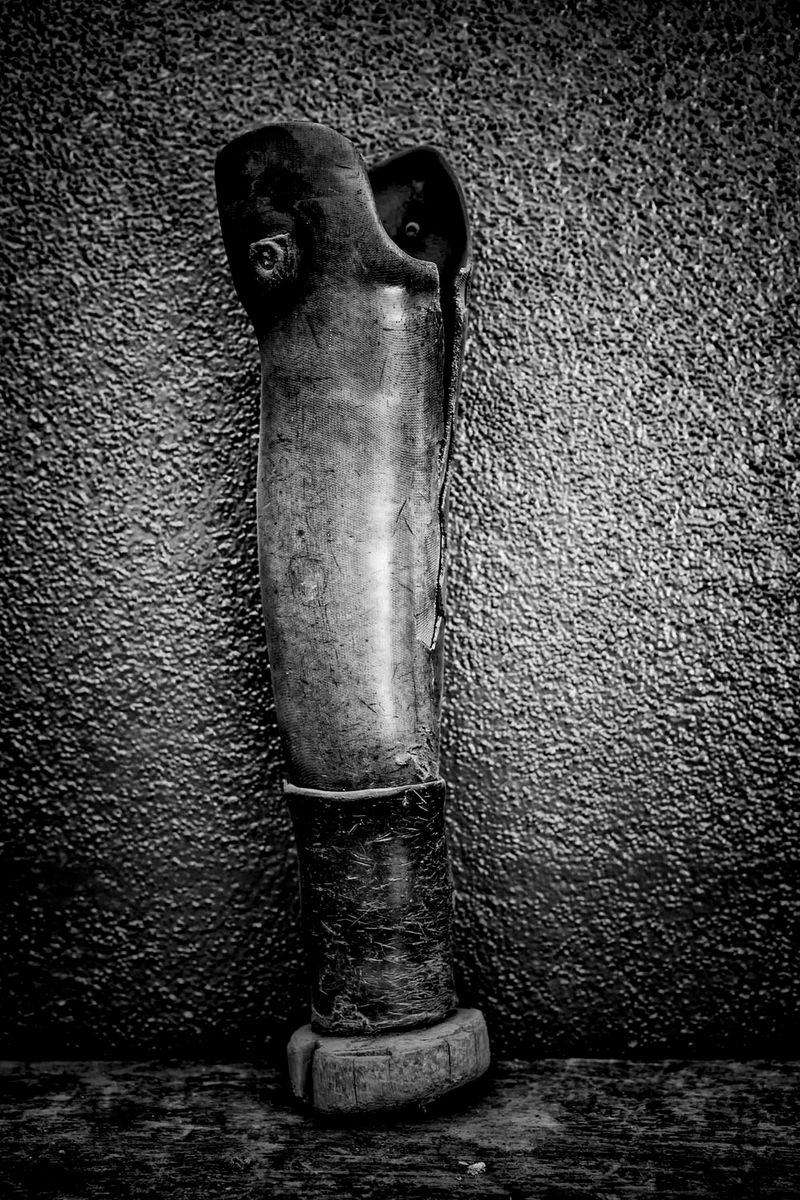 © Jose Silva Pinto - Image from the Lost Limbs photography project