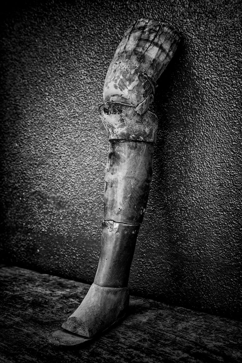 © Jose Silva Pinto - Image from the Lost Limbs photography project