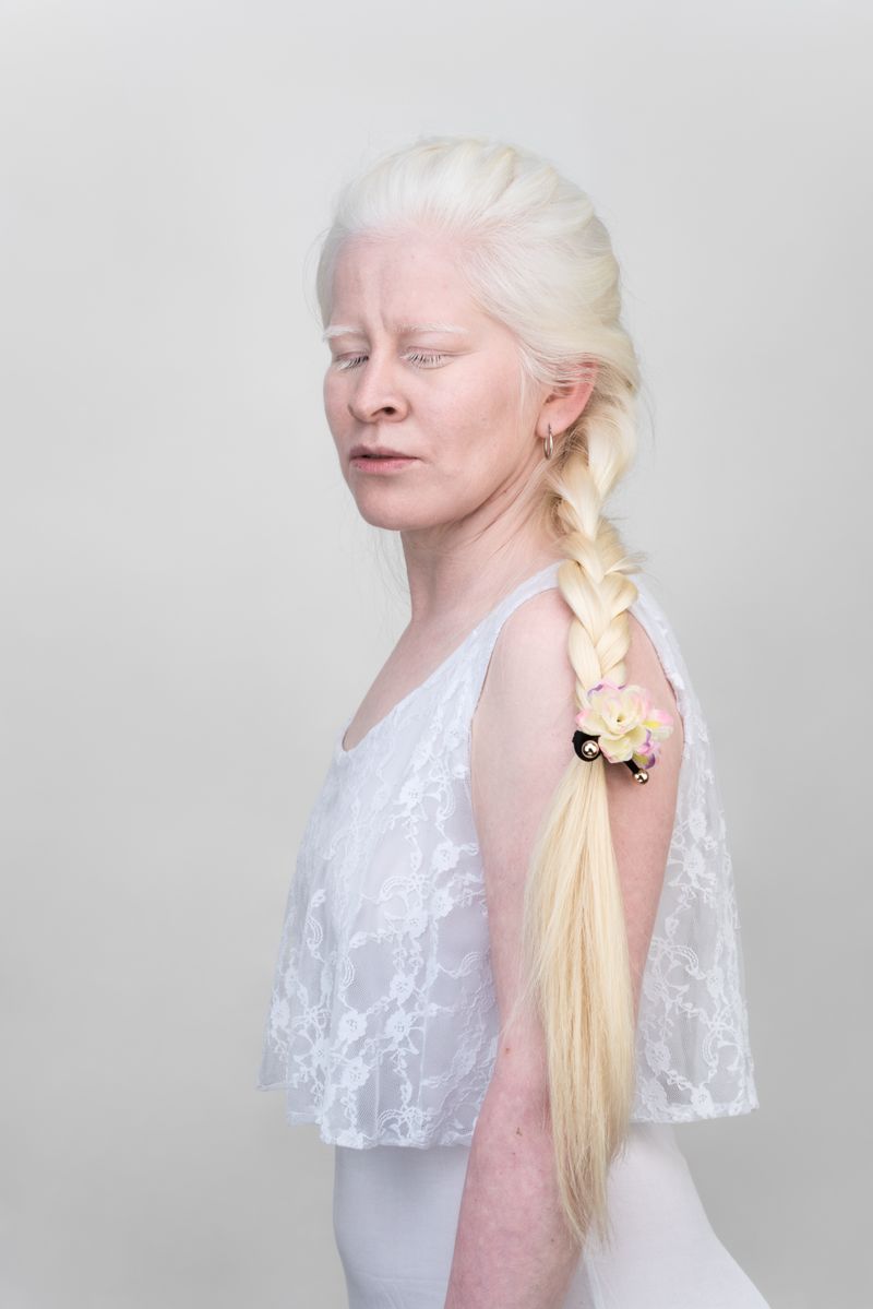 © Jorge Monaco - Image from the ALBINOS, BEING DIFFERENT photography project