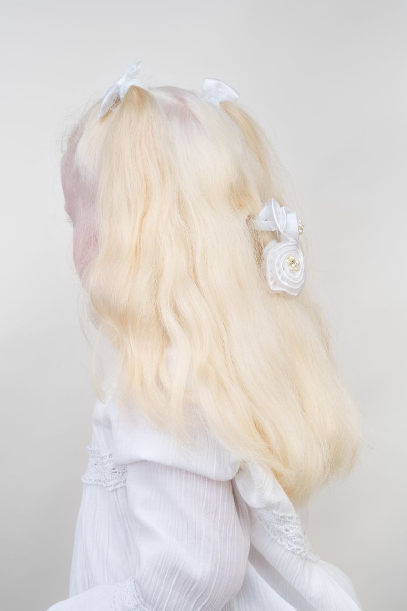 © Jorge Monaco - Image from the ALBINOS, BEING DIFFERENT photography project