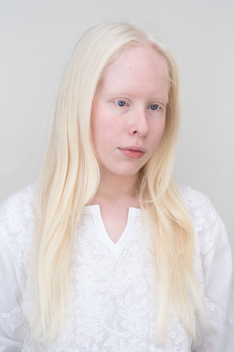 © Jorge Monaco - Image from the ALBINOS, BEING DIFFERENT photography project